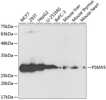 Western Blot: Proteasome 20S alpha 5 Antibody [NBP3-35411] - Western blot analysis of various lysates using Proteasome 20S alpha 5 Rabbit pAb at 1:1000 dilution.Secondary antibody: HRP-conjugated Goat anti-Rabbit IgG (H+L) at 1:10000 dilution.Lysates/proteins: 25ug per lane.Blocking buffer: 3% nonfat dry milk in TBST.