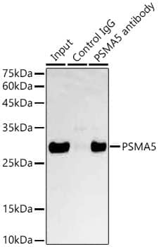 Immunoprecipitation: Proteasome 20S alpha 5 Antibody [NBP3-35411] - Immunoprecipitation analysis of 600 ug extracts of Mouse liver cells using 3 ug Proteasome 20S alpha 5 antibody. Western blot was performed from the immunoprecipitate using Proteasome 20S alpha 5 antibody at a dilution of  1:1000.