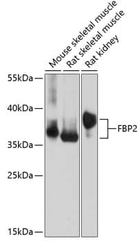 Western Blot: FBP2 Antibody [NBP3-35413] - Western blot analysis of various lysates using FBP2 Rabbit pAb at 1:1000 dilution.Secondary antibody: HRP-conjugated Goat anti-Rabbit IgG (H+L) at 1:10000 dilution.Lysates/proteins: 25ug per lane.Blocking buffer: 3% nonfat dry milk in TBST.Detection: ECL Basic Kit.Exposure time: 10s.
