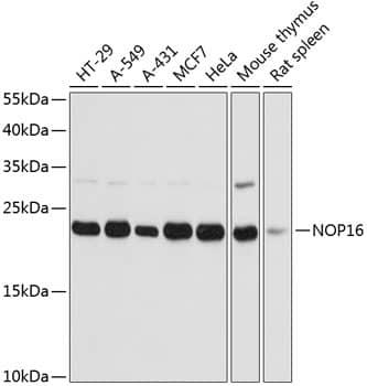 Western Blot: HSPC111 Antibody [NBP3-35414] - Western blot analysis of various lysates using HSPC111 Rabbit pAb at 1:3000 dilution.Secondary antibody: HRP-conjugated Goat anti-Rabbit IgG (H+L) at 1:10000 dilution.Lysates/proteins: 25ug per lane.Blocking buffer: 3% nonfat dry milk in TBST.Detection: ECL Basic Kit.Exposure time: 1s.