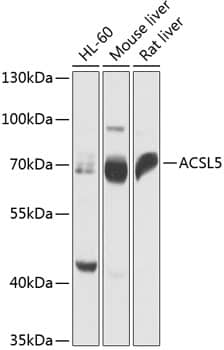 Western Blot: ACSL5 Antibody [NBP3-35416] - Western blot analysis of various lysates using ACSL5 Rabbit pAb at 1:1000 dilution.Secondary antibody: HRP-conjugated Goat anti-Rabbit IgG (H+L) at 1:10000 dilution.Lysates/proteins: 25ug per lane.Blocking buffer: 3% nonfat dry milk in TBST.Detection: ECL Basic Kit.Exposure time: 1s.