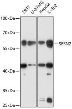 Western Blot: SESN2 Antibody [NBP3-35421] - Western blot analysis of various lysates using SESN2 Rabbit pAb at 1:3000 dilution.Secondary antibody: HRP-conjugated Goat anti-Rabbit IgG (H+L) at 1:10000 dilution.Lysates/proteins: 25ug per lane.Blocking buffer: 3% nonfat dry milk in TBST.Detection: ECL Basic Kit.Exposure time: 90s.