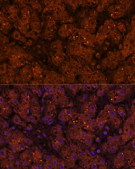 Immunocytochemistry/ Immunofluorescence: HMGCS2 Antibody [NBP3-35423] - Immunofluorescence analysis of paraffin-embedded mouse liver using HMGCS2 Rabbit pAb at dilution of 1:100 (40x lens). Secondary antibody: Cy3-conjugated Goat anti-Rabbit IgG (H+L) at 1:500 dilution. Blue: DAPI for nuclear staining.