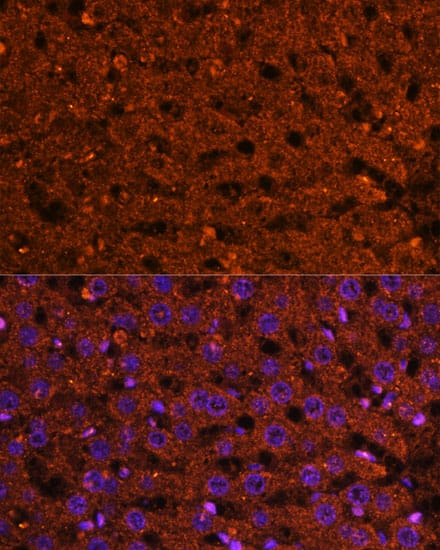 Immunocytochemistry/ Immunofluorescence: HMGCS2 Antibody [NBP3-35423] - Immunofluorescence analysis of paraffin-embedded human liver using HMGCS2 Rabbit pAb at dilution of 1:100 (40x lens). Secondary antibody: Cy3-conjugated Goat anti-Rabbit IgG (H+L) at 1:500 dilution. Blue: DAPI for nuclear staining.
