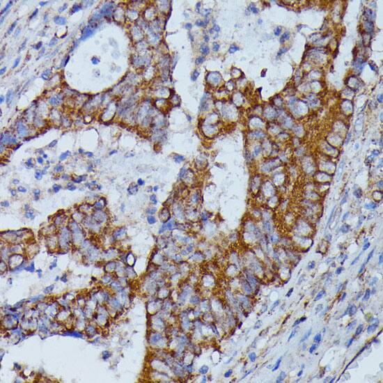 Immunocytochemistry/ Immunofluorescence HMGCS2 Antibody - BSA Free