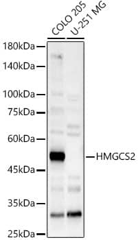 Western Blot: HMGCS2 Antibody [NBP3-35423] - Western Blot analysis of various lysates using HMGCS2 Rabbit pAb at 1:7000 dilution. Secondary antibody: HRP-conjugated Goat anti-Rabbit IgG (H+L) at 1:10000 dilution. Lysates / proteins: 25 ug per lane. Blocking buffer: 3 % nonfat dry milk in TBST. Detection: ECL Basic Kit. Exposure time: 30s.