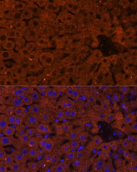 Immunocytochemistry/ Immunofluorescence: HMGCS2 Antibody [NBP3-35423] - Immunofluorescence analysis of paraffin-embedded mouse liver using HMGCS2 Rabbit pAb at dilution of 1:100 (40x lens). Secondary antibody: Cy3-conjugated Goat anti-Rabbit IgG (H+L) at 1:500 dilution. Blue: DAPI for nuclear staining.