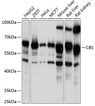 Western Blot: CBS Antibody [NBP3-35425] - Western blot analysis of various lysates using CBS Rabbit pAb at 1:1000 dilution.Secondary antibody: HRP-conjugated Goat anti-Rabbit IgG (H+L) at 1:10000 dilution.Lysates/proteins: 25ug per lane.Blocking buffer: 3% nonfat dry milk in TBST.Detection: ECL Basic Kit.Exposure time: 1s.