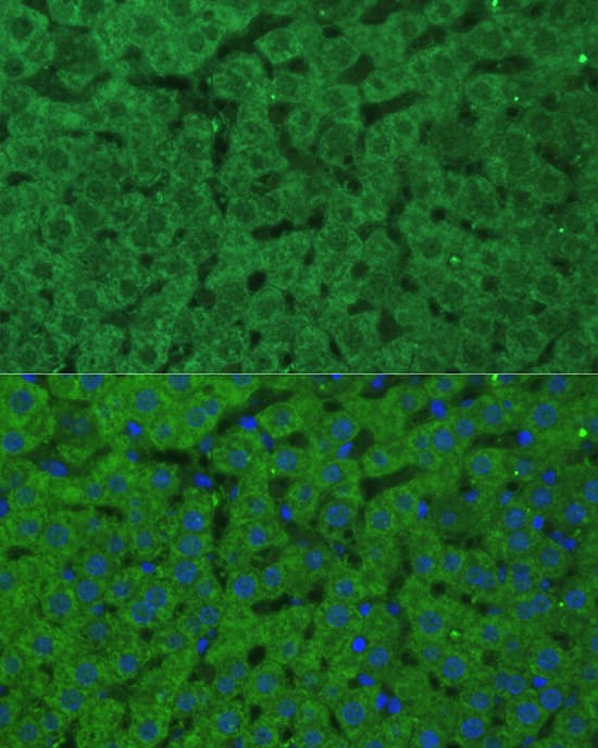 Immunocytochemistry/ Immunofluorescence: CBS Antibody [NBP3-35425] - Immunofluorescence analysis of paraffin-embedded rat liver using CBS Rabbit pAb at dilution of 1:100 (40x lens). Secondary antibody: Cy3-conjugated Goat anti-Rabbit IgG (H+L) at 1:500 dilution. Blue: DAPI for nuclear staining.