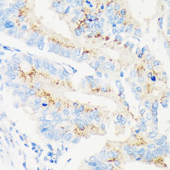 Immunohistochemistry MAN1A2 Antibody - BSA Free