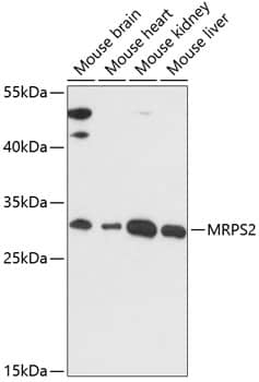 Western Blot: MRPS2 Antibody [NBP3-35427] - Western blot analysis of various lysates using MRPS2 Rabbit pAb at 1:3000 dilution.Secondary antibody: HRP-conjugated Goat anti-Rabbit IgG (H+L) at 1:10000 dilution.Lysates/proteins: 25ug per lane.Blocking buffer: 3% nonfat dry milk in TBST.Detection: ECL Basic Kit.Exposure time: 90s.