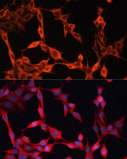 Immunocytochemistry/ Immunofluorescence: SLC25A23 Antibody [NBP3-35429] - Immunofluorescence analysis of NIH/3T3 cells using SLC25A23 Rabbit pAb at dilution of 1:100. Secondary antibody: Cy3-conjugated Goat anti-Rabbit IgG (H+L) at 1:500 dilution. Blue: DAPI for nuclear staining.