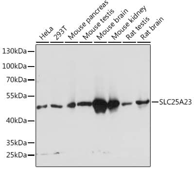 Western Blot: SLC25A23 Antibody [NBP3-35429] - Western blot analysis of various lysates using SLC25A23 Rabbit pAb at 1:1000 dilution.Secondary antibody: HRP-conjugated Goat anti-Rabbit IgG (H+L) at 1:10000 dilution.Lysates/proteins: 25ug per lane.Blocking buffer: 3% nonfat dry milk in TBST.Detection: ECL Basic Kit.Exposure time: 3s.