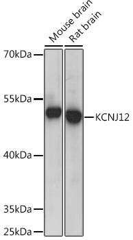 Western Blot: Kir2.2 Antibody [NBP3-35430] - Western blot analysis of various lysates using Kir2.2 Rabbit pAb at 1:300 dilution.Secondary antibody: HRP-conjugated Goat anti-Rabbit IgG (H+L) at 1:10000 dilution.Lysates/proteins: 25ug per lane.Blocking buffer: 3% nonfat dry milk in TBST.Detection: ECL Basic Kit.Exposure time: 5s.