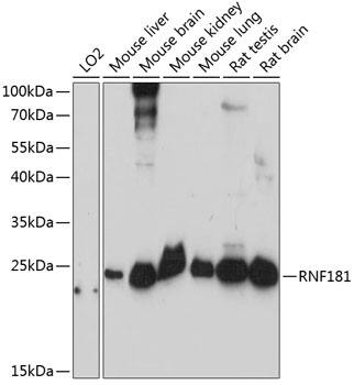 Western Blot: RNF181 Antibody [NBP3-35431] - Western blot analysis of various lysates using RNF181 Rabbit pAb at 1:3000 dilution.Secondary antibody: HRP-conjugated Goat anti-Rabbit IgG (H+L) at 1:10000 dilution.Lysates/proteins: 25ug per lane.Blocking buffer: 3% nonfat dry milk in TBST.Detection: ECL Basic Kit.Exposure time: 90s.