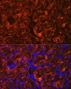 Immunocytochemistry/ Immunofluorescence: MIOX Antibody [NBP3-35432] - Immunofluorescence analysis of paraffin-embedded Rat kidney using MIOX Rabbit pAb at dilution of 1:100. Secondary antibody: Cy3-conjugated Goat anti-Rabbit IgG (H+L) at 1:500 dilution. Blue: DAPI for nuclear staining.