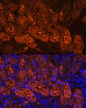 Immunocytochemistry/ Immunofluorescence: MIOX Antibody [NBP3-35432] - Immunofluorescence analysis of paraffin-embedded Mouse kidney using MIOX Rabbit pAb at dilution of 1:100. Secondary antibody: Cy3-conjugated Goat anti-Rabbit IgG (H+L) at 1:500 dilution. Blue: DAPI for nuclear staining.