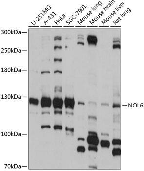 Western Blot: NOL6 Antibody [NBP3-35433] - Western blot analysis of various lysates using NOL6 Rabbit pAb at 1:1000 dilution.Secondary antibody: HRP-conjugated Goat anti-Rabbit IgG (H+L) at 1:10000 dilution.Lysates/proteins: 25ug per lane.Blocking buffer: 3% nonfat dry milk in TBST.Detection: ECL Basic Kit.Exposure time: 15s.