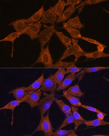 Immunocytochemistry/ Immunofluorescence NMNAT3 Antibody