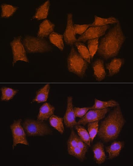 Immunocytochemistry/ Immunofluorescence NMNAT3 Antibody