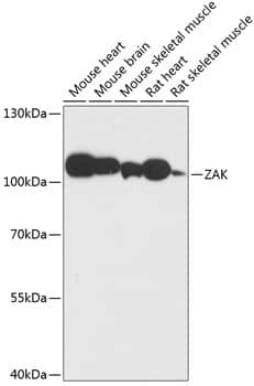 Western Blot: ZAK Antibody [NBP3-35439] - Western blot analysis of various lysates using ZAK Rabbit pAb at 1:3000 dilution.Secondary antibody: HRP-conjugated Goat anti-Rabbit IgG (H+L) at 1:10000 dilution.Lysates/proteins: 25ug per lane.Blocking buffer: 3% nonfat dry milk in TBST.Detection: ECL Basic Kit.Exposure time: 90s.