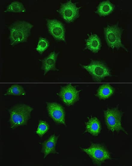 Immunocytochemistry/ Immunofluorescence: ZAK Antibody [NBP3-35439] - Immunofluorescence analysis of L929 cells using ZAK Rabbit pAb at dilution of 1:100. Secondary antibody: Cy3-conjugated Goat anti-Rabbit IgG (H+L) at 1:500 dilution. Blue: DAPI for nuclear staining.