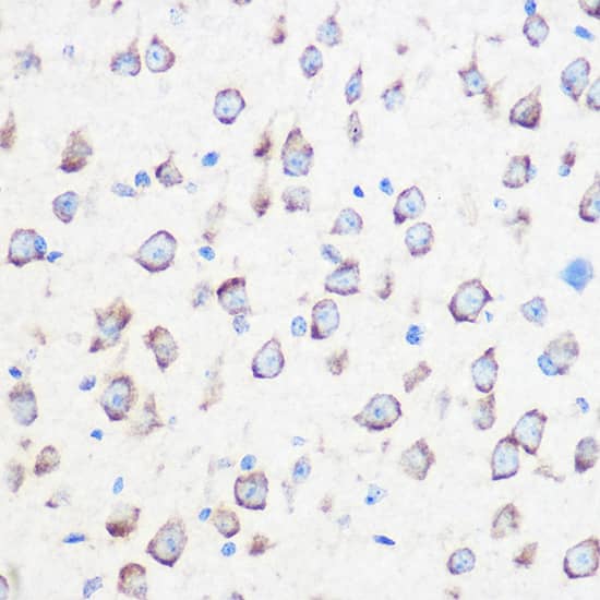 Immunohistochemistry: Calmodulin 3 Antibody [NBP3-35441] - Immunohistochemistry analysis of paraffin-embedded Mouse brain using Calmodulin 3 Rabbit pAb at dilution of 1:100 (40x lens). Microwave antigen retrieval performed with 0.01M Tris/EDTA Buffer (pH 9.0) prior to IHC staining.