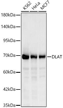 Western Blot: Pyruvate Dehydrogenase E2 Antibody [NBP3-35442] - Western blot analysis of various lysates, using Pyruvate Dehydrogenase E2 Rabbit pAb at 1:1000 dilution.Secondary antibody: HRP-conjugated Goat anti-Rabbit IgG (H+L) at 1:10000 dilution.Lysates/proteins: 25ug per lane.Blocking buffer: 3% nonfat dry milk in TBST.Detection: ECL Basic Kit.Exposure time: 10s.