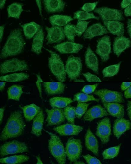 Immunocytochemistry/ Immunofluorescence: Pyruvate Dehydrogenase E2 Antibody [NBP3-35442] - Immunofluorescence analysis of Hep G2 cells using Pyruvate Dehydrogenase E2 Rabbit pAb at a dilution of 1:200 (40x lens). Secondary antibody: Cy3-conjugated Goat anti-Rabbit IgG (H+L) at 1:500 dilution. Blue: DAPI for nuclear staining.