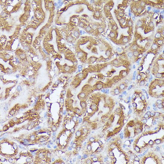 Immunohistochemistry: Pyruvate Dehydrogenase E2 Antibody [NBP3-35442] - Immunohistochemistry analysis of paraffin-embedded Human tonsil tissue using Pyruvate Dehydrogenase E2 Rabbit pAb at a dilution of 1:200 (40x lens). High pressure antigen retrieval performed with 0.01M Citrate Bufferr (pH 6.0) prior to IHC staining.