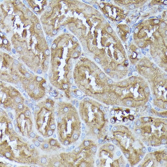 Immunohistochemistry: Pyruvate Dehydrogenase E2 Antibody [NBP3-35442] - Immunohistochemistry analysis of paraffin-embedded Human liver tissue using Pyruvate Dehydrogenase E2 Rabbit pAb at a dilution of 1:200 (40x lens). High pressure antigen retrieval performed with 0.01M Citrate Bufferr (pH 6.0) prior to IHC staining.