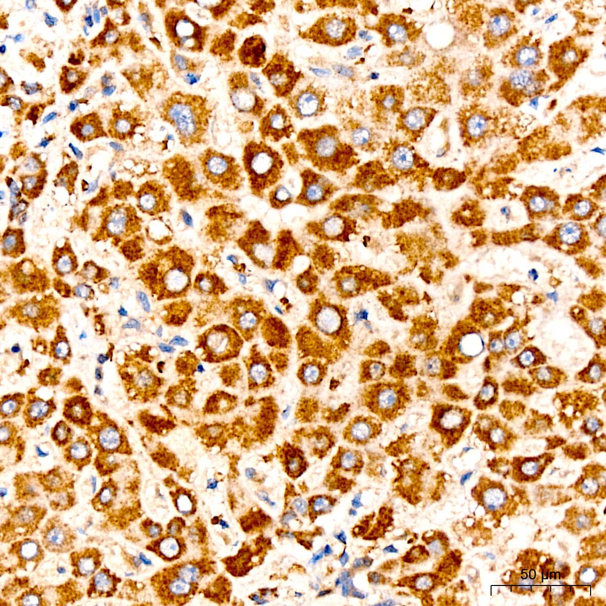 N/A Pyruvate Dehydrogenase E2 Antibody