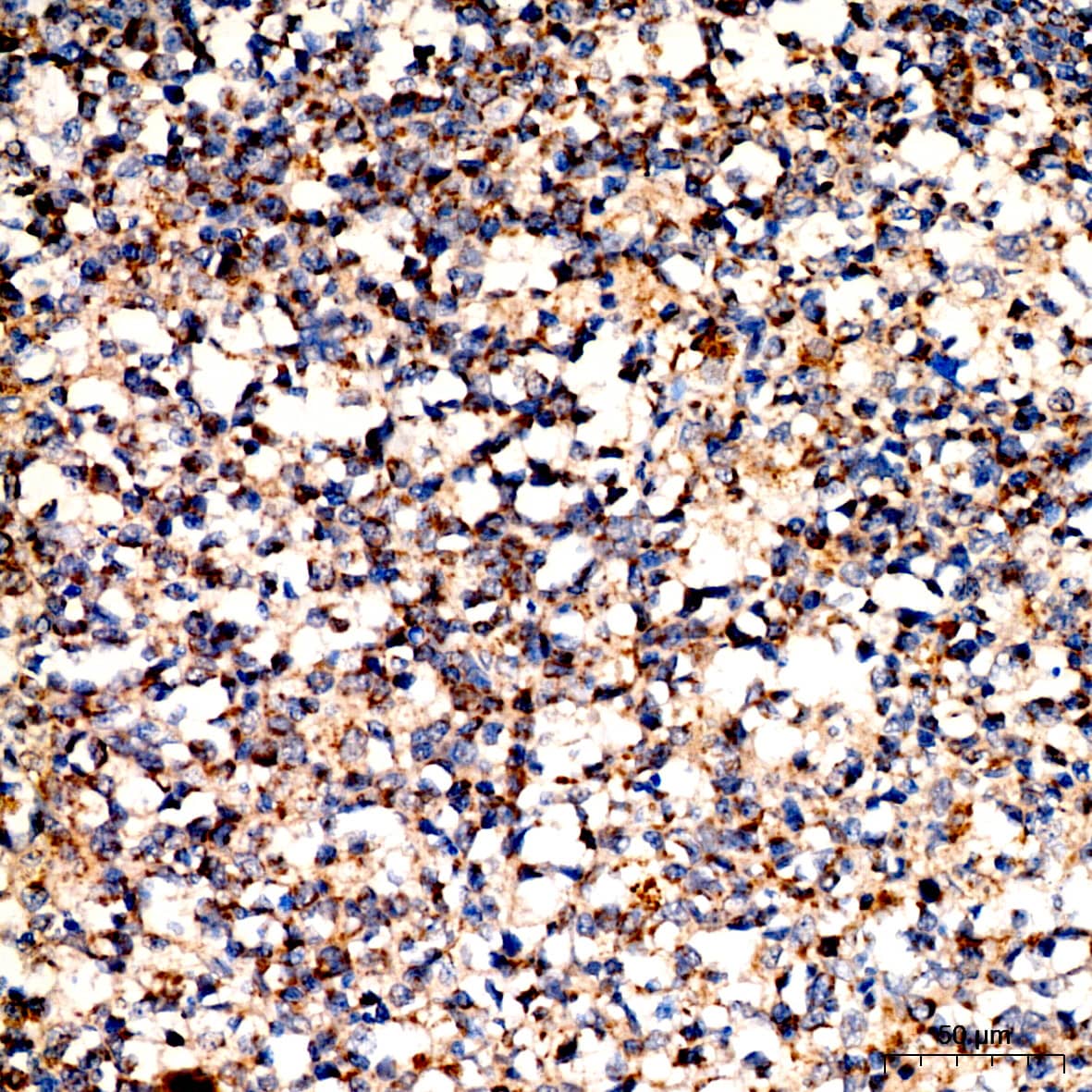 Immunohistochemistry: Pyruvate Dehydrogenase E2 Antibody [NBP3-35442] - Immunohistochemistry analysis of paraffin-embedded Human tonsil tissue using Pyruvate Dehydrogenase E2 Rabbit pAb at a dilution of 1:200 (40x lens). High pressure antigen retrieval performed with 0.01M Citrate Bufferr (pH 6.0) prior to IHC staining.