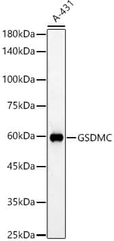 Western Blot: Gasdermin-C Antibody [NBP3-35443] - Western blot analysis of various lysates, using Gasdermin-C Rabbit pAb at 1:500 dilution.Secondary antibody: HRP-conjugated Goat anti-Rabbit IgG (H+L) at 1:10000 dilution.Lysates/proteins: 25ug per lane.Blocking buffer: 3% nonfat dry milk in TBST.Detection: ECL Basic Kit.Exposure time: 60s.