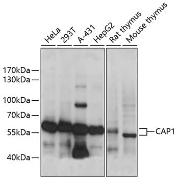 Western Blot: CAP1 Antibody [NBP3-35444] - Western blot analysis of various lysates using CAP1 Rabbit pAb at 1:1000 dilution.Secondary antibody: HRP-conjugated Goat anti-Rabbit IgG (H+L) at 1:10000 dilution.Lysates/proteins: 25ug per lane.Blocking buffer: 3% nonfat dry milk in TBST.Detection: ECL Basic Kit.Exposure time: 1s.