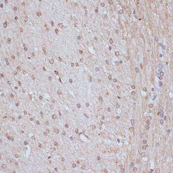 Immunohistochemistry: SNW1 Antibody [NBP3-35445] - Immunohistochemistry analysis of paraffin-embedded Rat brain using SNW1 Rabbit pAb at dilution of 1:100 (40x lens). Microwave antigen retrieval performed with 0.01M PBS Buffer (pH 7.2) prior to IHC staining.