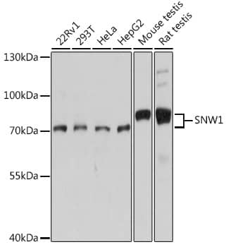 Western Blot: SNW1 Antibody [NBP3-35445] - Western blot analysis of various lysates using SNW1 Rabbit pAb at 1:1000 dilution.Secondary antibody: HRP-conjugated Goat anti-Rabbit IgG (H+L) at 1:10000 dilution.Lysates/proteins: 25ug per lane.Blocking buffer: 3% nonfat dry milk in TBST.Detection: ECL Basic Kit.Exposure time: 10s.