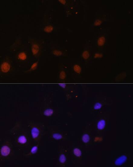 Immunocytochemistry/ Immunofluorescence: SNW1 Antibody [NBP3-35445] - Immunofluorescence analysis of U-2 OS cells using SNW1 Rabbit pAb at dilution of 1:100. Secondary antibody: Cy3-conjugated Goat anti-Rabbit IgG (H+L) at 1:500 dilution. Blue: DAPI for nuclear staining.