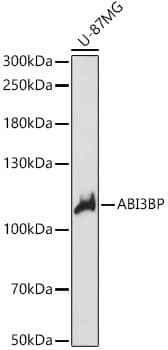 Western Blot: TARSH Antibody [NBP3-35446] - Western blot analysis of lysates from U-87MG cells, using TARSH Rabbit pAb at 1:1000 dilution.Secondary antibody: HRP-conjugated Goat anti-Rabbit IgG (H+L) at 1:10000 dilution.Lysates/proteins: 25ug per lane.Blocking buffer: 3% nonfat dry milk in TBST.Detection: ECL Basic Kit.Exposure time: 20s.