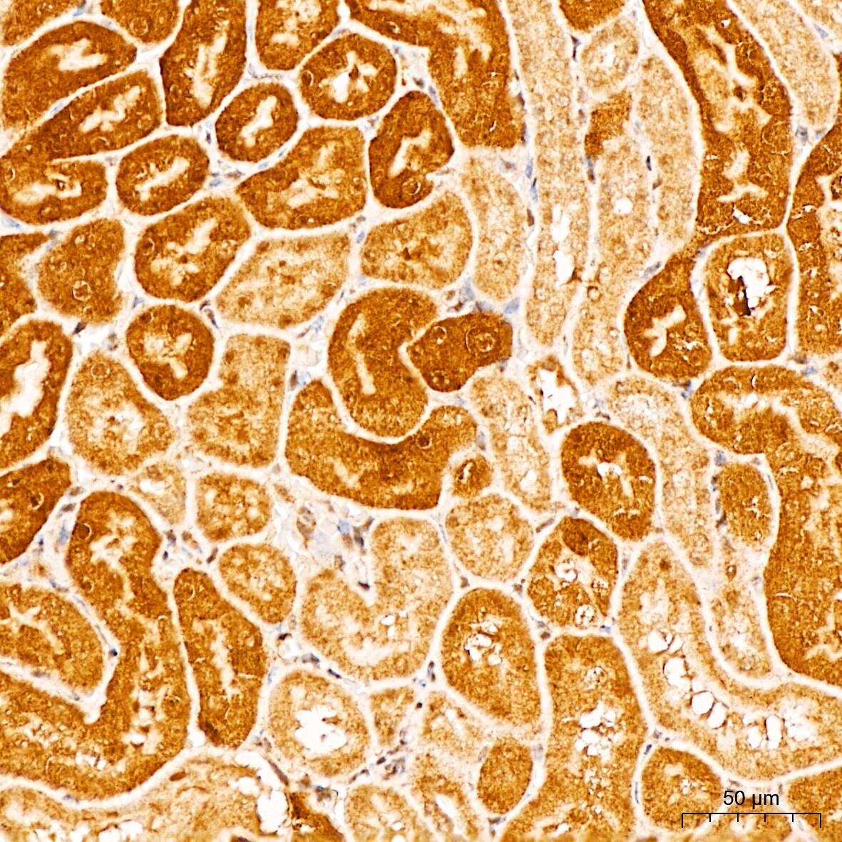 Immunohistochemistry: APOBEC3G Antibody [NBP3-35447] - Immunohistochemistry analysis of paraffin-embedded Mouse kidney tissue using APOBEC3G Rabbit pAb at a dilution of 1:300 (40x lens). High pressure antigen retrieval performed with 0.01M Citrate Bufferr (pH 6.0) prior to IHC staining.