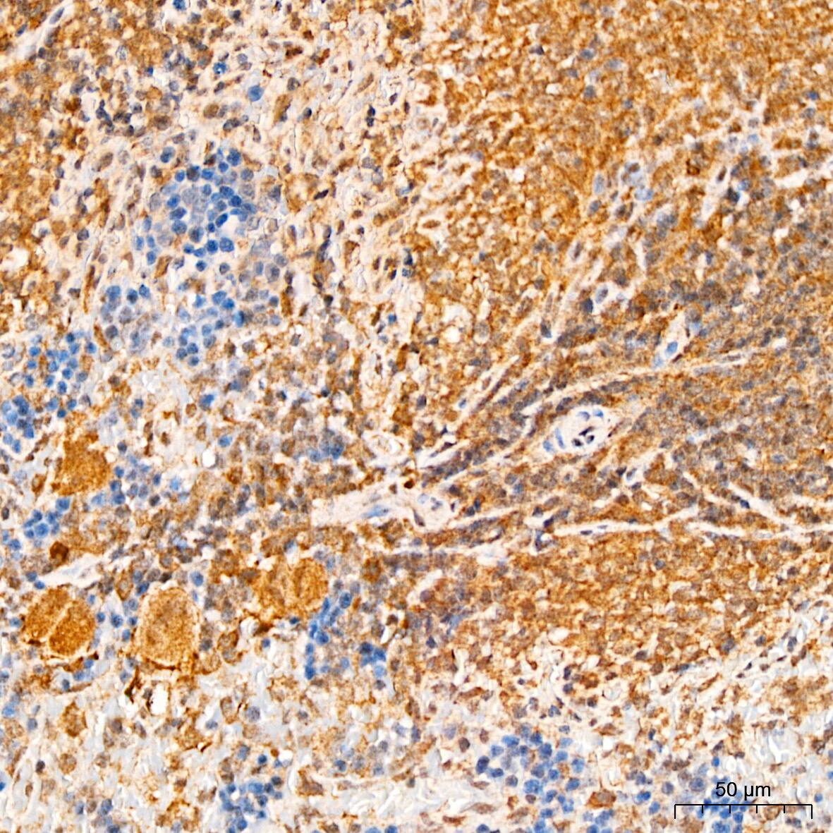 Immunohistochemistry: APOBEC3G Antibody [NBP3-35447] - Immunohistochemistry analysis of paraffin-embedded Rat spleen tissue using APOBEC3G Rabbit pAb at a dilution of 1:300 (40x lens). High pressure antigen retrieval performed with 0.01M Citrate Bufferr (pH 6.0) prior to IHC staining.