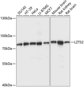 Western Blot: LZTS2 Antibody [NBP3-35448] - Western blot analysis of various lysates using LZTS2 Rabbit pAb at 1:1000 dilution.Secondary antibody: HRP-conjugated Goat anti-Rabbit IgG (H+L) at 1:10000 dilution.Lysates/proteins: 25ug per lane.Blocking buffer: 3% nonfat dry milk in TBST.Detection: ECL Basic Kit.Exposure time: 5s.