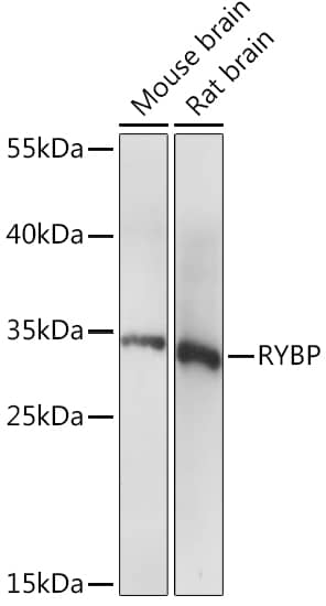 Western Blot: RYBP/DEDAF Antibody [NBP3-35449] - Western blot analysis of various lysates using RYBP/DEDAF Rabbit pAb at 1:1000 dilution.Secondary antibody: HRP-conjugated Goat anti-Rabbit IgG (H+L) at 1:10000 dilution.Lysates/proteins: 25ug per lane.Blocking buffer: 3% nonfat dry milk in TBST.Detection: ECL Basic Kit.Exposure time: 10s.