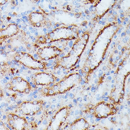 Immunohistochemistry: IDH3A Antibody [NBP3-35451] - Immunohistochemistry analysis of paraffin-embedded Rat kidney using IDH3A Rabbit pAb at dilution of 1:100 (40x lens). Microwave antigen retrieval performed with 0.01M PBS Buffer (pH 7.2) prior to IHC staining.