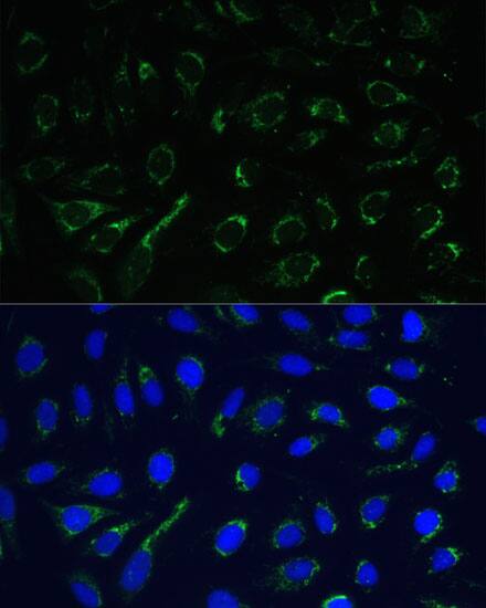 Immunocytochemistry/ Immunofluorescence: IDH3A Antibody [NBP3-35451] - Immunofluorescence analysis of U-2 OS cells using IDH3A Rabbit pAb at dilution of 1:100. Secondary antibody: Cy3-conjugated Goat anti-Rabbit IgG (H+L) at 1:500 dilution. Blue: DAPI for nuclear staining.
