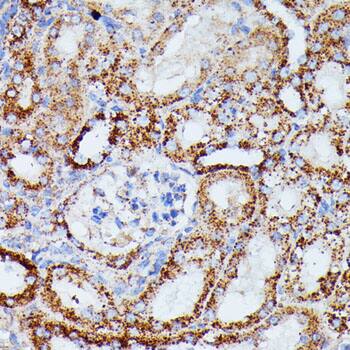 Immunohistochemistry: IDH3A Antibody [NBP3-35451] - Immunohistochemistry analysis of paraffin-embedded Mouse kidney using IDH3A Rabbit pAb at dilution of 1:100 (40x lens). Microwave antigen retrieval performed with 0.01M PBS Buffer (pH 7.2) prior to IHC staining.