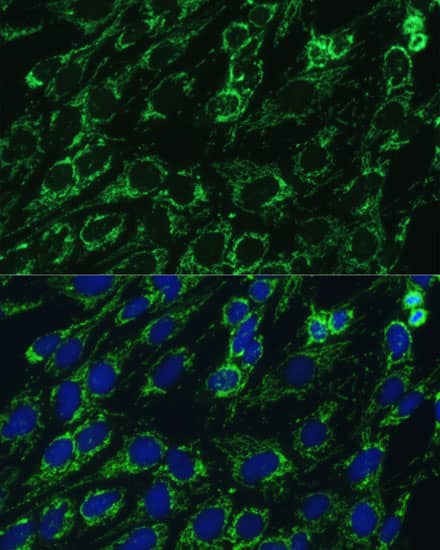 Immunocytochemistry/ Immunofluorescence: IDH3A Antibody [NBP3-35451] - Immunofluorescence analysis of C6 cells using IDH3A Rabbit pAb at dilution of 1:100. Secondary antibody: Cy3-conjugated Goat anti-Rabbit IgG (H+L) at 1:500 dilution. Blue: DAPI for nuclear staining.