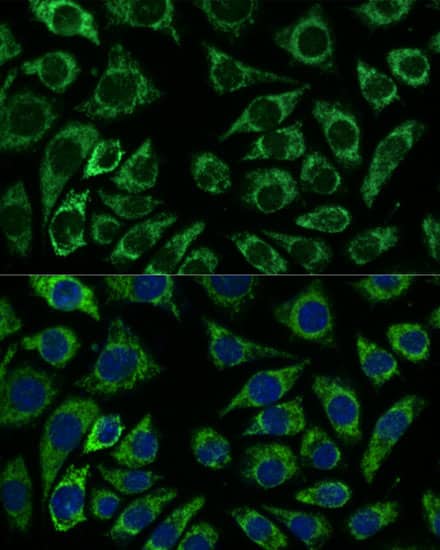 Immunocytochemistry/ Immunofluorescence: IDH3A Antibody [NBP3-35451] - Immunofluorescence analysis of L929 cells using IDH3A Rabbit pAb at dilution of 1:100. Secondary antibody: Cy3-conjugated Goat anti-Rabbit IgG (H+L) at 1:500 dilution. Blue: DAPI for nuclear staining.