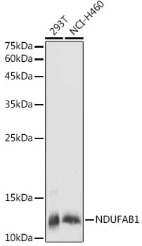 Western Blot: NDUFAB1 Antibody [NBP3-35453] - Western blot analysis of various lysates using NDUFAB1 Rabbit pAb at 1:1000 dilution.Secondary antibody: HRP-conjugated Goat anti-Rabbit IgG (H+L) at 1:10000 dilution.Lysates/proteins: 25ug per lane.Blocking buffer: 3% nonfat dry milk in TBST.Detection: ECL Basic Kit.Exposure time: 5s.