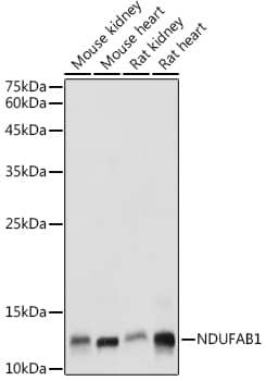 Western Blot: NDUFAB1 Antibody [NBP3-35453] - Western blot analysis of various lysates using NDUFAB1 Rabbit pAb at 1:1000 dilution.Secondary antibody: HRP-conjugated Goat anti-Rabbit IgG (H+L) at 1:10000 dilution.Lysates/proteins: 25ug per lane.Blocking buffer: 3% nonfat dry milk in TBST.Detection: ECL Basic Kit.Exposure time: 1s.